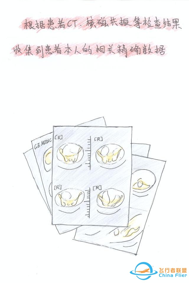 醫(yī)學(xué)領(lǐng)域的“AR 3D”技術(shù)究竟有多炫？10幅手繪漫畫給你講透-3883