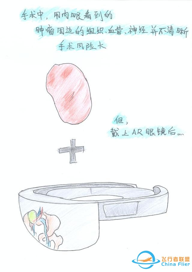 醫(yī)學(xué)領(lǐng)域的“AR 3D”技術(shù)究竟有多炫？10幅手繪漫畫給你講透-53