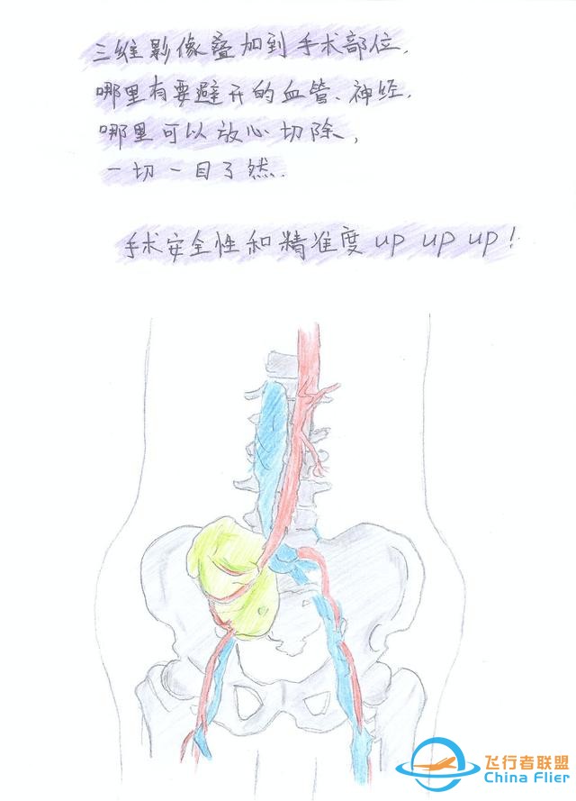 醫(yī)學(xué)領(lǐng)域的“AR 3D”技術(shù)究竟有多炫？10幅手繪漫畫給你講透-4223