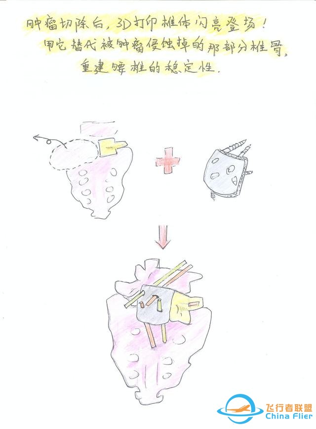 醫(yī)學(xué)領(lǐng)域的“AR 3D”技術(shù)究竟有多炫？10幅手繪漫畫給你講透-8291